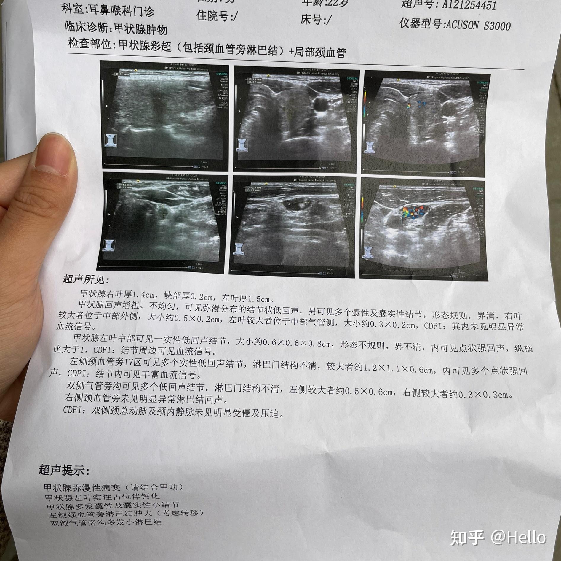 关于131检查的全过程解析,全面解析131检查过程,步骤、细节及应用