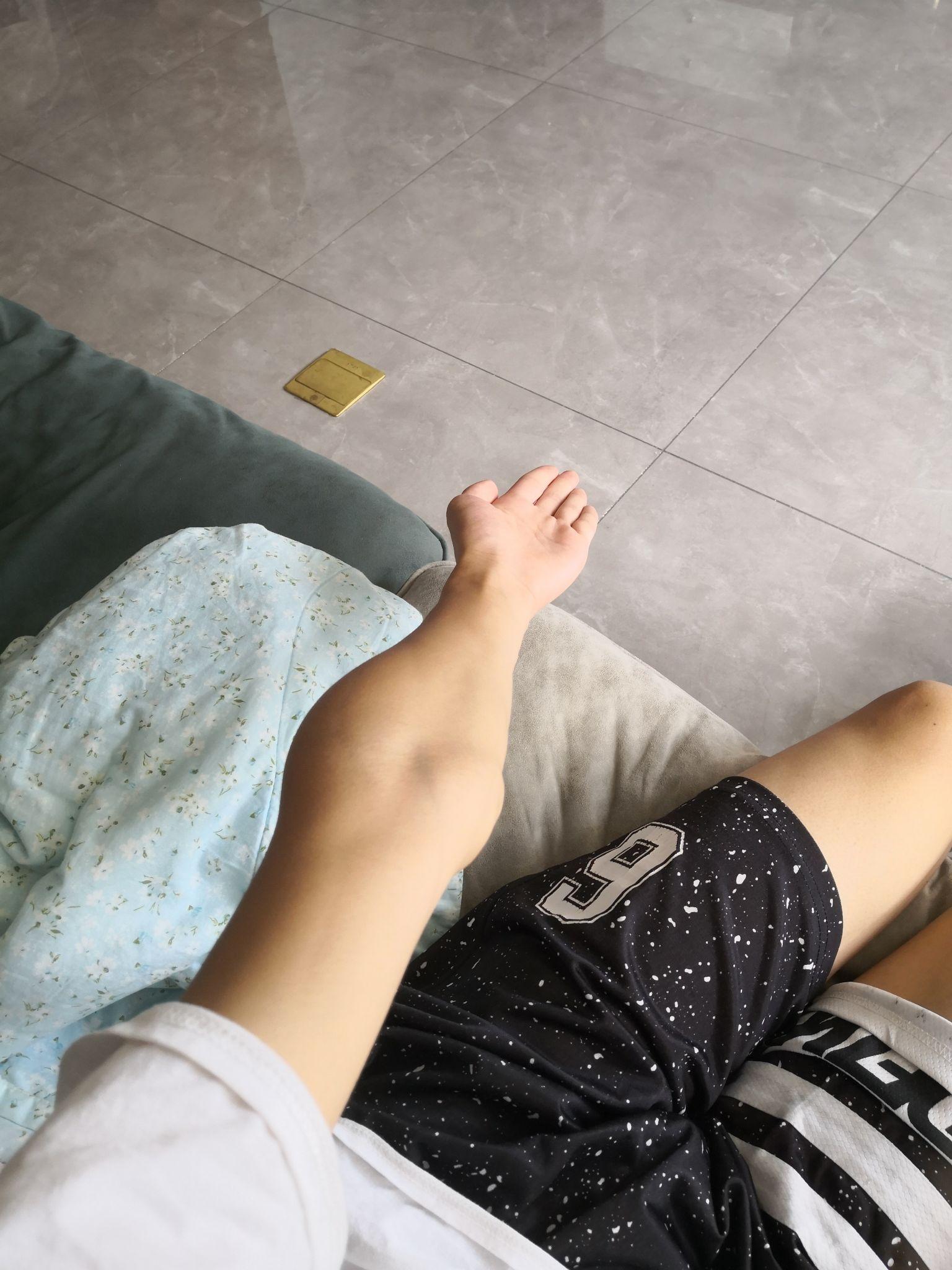 肘外翻20度兵检过了,一个关于健康与机遇的探讨,肘外翻20度兵检通过背后的健康与机遇探讨